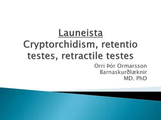 Understanding Absent Testis and Undescended Testes