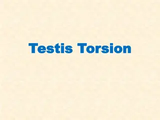 Testis Torsion: Causes, Symptoms & Diagnosis