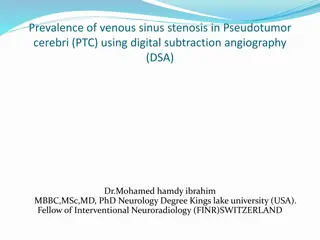 Prevalence of Venous Sinus Stenosis in Pseudotumor Cerebri (PTC)