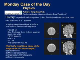 Pediatric Head MRI: Motion Correction Failure