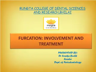 Furcation Involvement in Periodontal Disease
