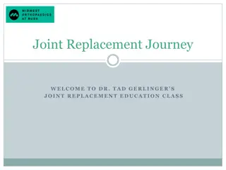 Knee and Hip Joint Replacement Surgery