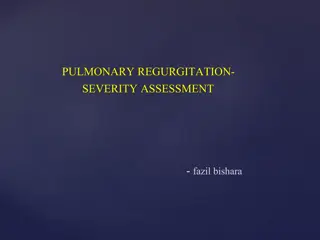 Assessment of Pulmonary Regurgitation Severity and Diagnostic Methods