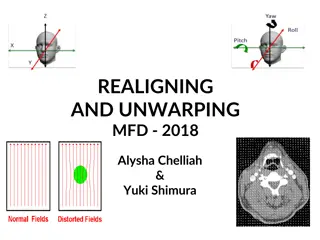 fMRI Preprocessing and Motion Correction in SPM