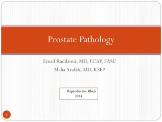 Benign Prostatic Hyperplasia (BPH) and Prostate Pathology