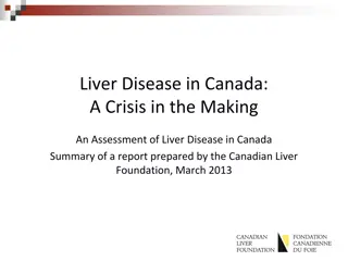 Assessment of Liver Disease in Canada: A Comprehensive Review
