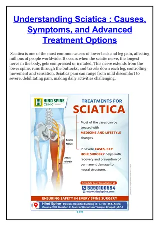Understanding Sciatica - Hind Spine Clinic
