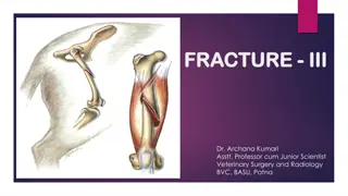 Types and Characteristics of Bone Fractures