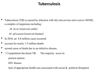 Tuberculosis: Causes, Risk Factors, and Clinical Features