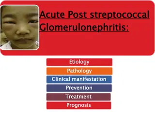 Acute Post-Streptococcal Glomerulonephritis: Etiology, Pathology, and Clinical Manifestations
