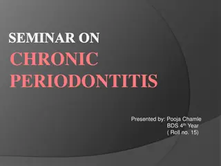 Chronic Periodontitis: Causes, Symptoms & Management