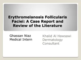 Erythromelanosis Follicularis Faciei: A Comprehensive Case Report