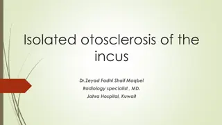 Rare Case of Isolated Otosclerosis of the Incus in a 50-Year-Old Woman
