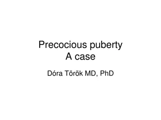 Idiopathic Central Precocious Puberty in Children