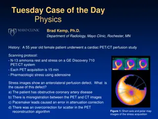 PET/CT Imaging Artifacts: Misregistration Case Study