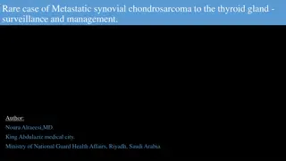 Metastatic Synovial Chondrosarcoma to Thyroid: Surveillance and Management