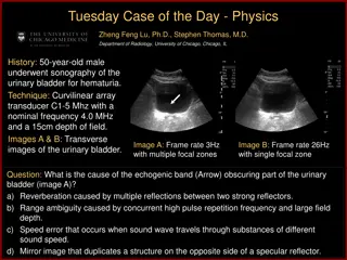 Range Ambiguity Artifact in Ultrasound Imaging