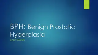 Benign Prostatic Hyperplasia (BPH) in a 67-Year-Old Male