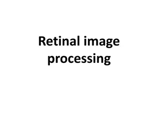 Retinal Image Processing and Disorders