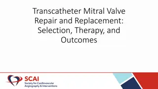Mitral Valve Repair and Replacement: Selection, Therapy, Outcomes