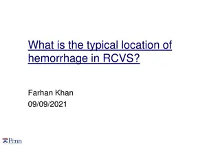 Location of Hemorrhage in RCVS: Insights from Studies
