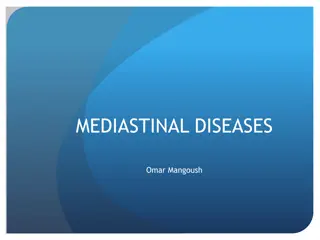 Mediastinal Diseases: Anatomy, Pathology, and Clinical Presentation