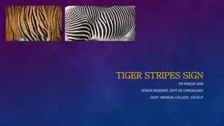 Tiger Stripes Sign in Cardiology: Mechanism & Specificity