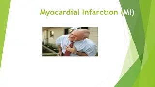 Understanding Myocardial Infarction (MI)