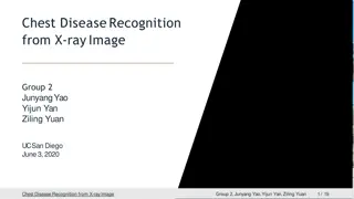 Advanced Techniques in Chest X-ray Image Recognition