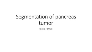 Pancreas Tumor Segmentation and Medical Image Analysis