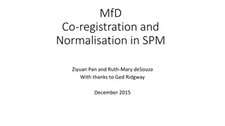 Co-registration and Normalisation in SPM