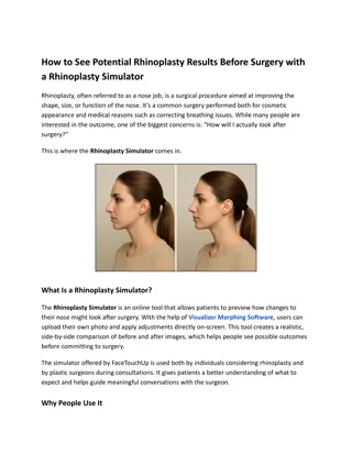 See Potential Rhinoplasty Results Before Surgery with a Rhinoplasty Simulator
