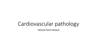 Valvular Heart Disease and Endocarditis