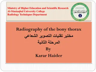 Radiology Techniques: Radiography of the Bony Thorax