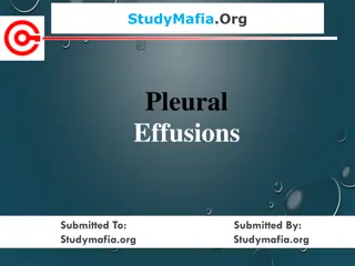Pleural Effusions: Causes, Symptoms, and Treatment