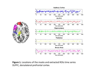 Role of DLPFC in Auditory Hallucinations