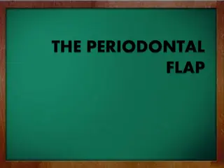 Periodontal Flap Surgery
