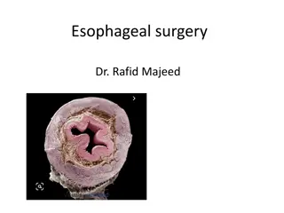 Esophageal Surgery and Dysfunction