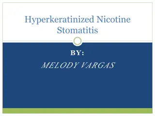 Hyperkeratinized Nicotine Stomatitis