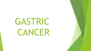Gastric Cancer: Symptoms, Diagnosis, and Management