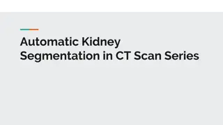 Automatic Kidney Segmentation in CT Scan Series Using Spine Landmark and Soft Clustering