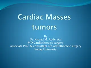 Cardiac Masses: Introduction, Classification, and Presentation