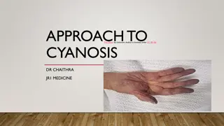 Cyanosis: Causes, Symptoms, and Differential Diagnosis