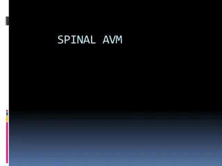 Spinal Arteriovenous Malformations (AVMs): An Overview