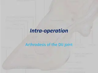 Arthrodesis of DIJ and DIP Joints in Cattle