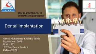 Dental Implantation and Tissue Regeneration