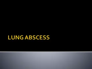 Lung Abscess: Causes, Symptoms, and Treatment