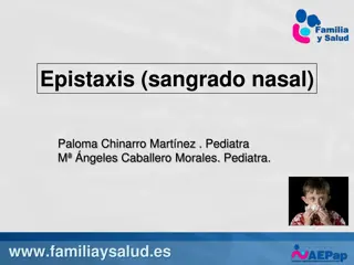Epistaxis: Causes, Treatment, and Prevention