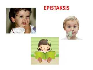 Epistaxis: Causes, Symptoms, and Care
