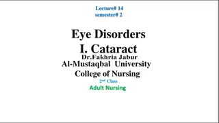 Eye Disorders: Understanding Cataract Development
